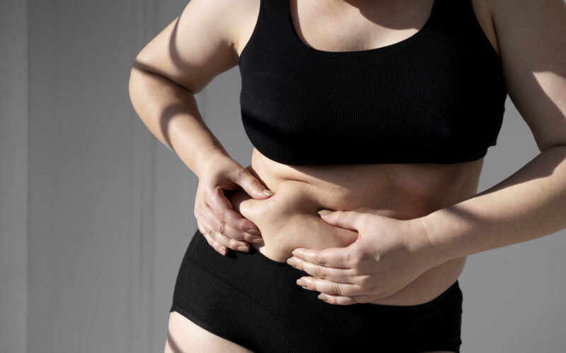 HOW CAN I GET RID OF MY PCOS BELLY ?